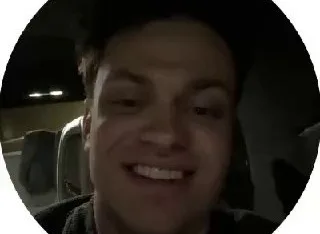 😎 Buster готовится к установке виниров Сейчас у него стоят временные коронки.