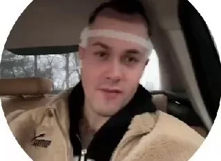 😌 Mafanya сообщил, что успешно перенёс операцию по пересадке волос