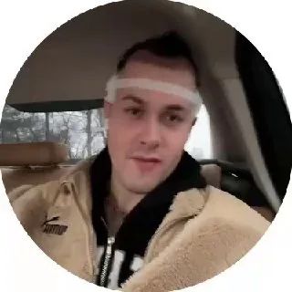 😌 Mafanya сообщил, что успешно перенёс операцию по пересадке волос