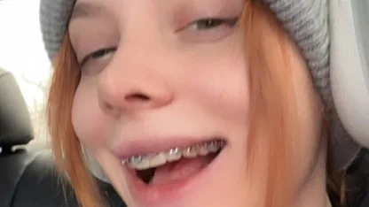 😊 Fasoollka поставила брекеты Я психанула, приехала и сказала ставить мне брекеты…