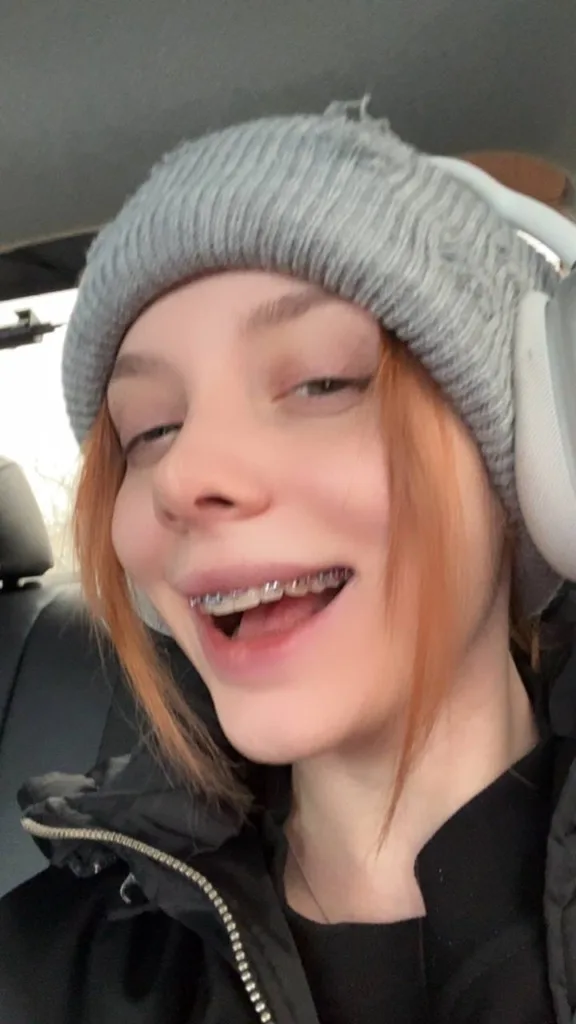 😊 Fasoollka поставила брекеты Я психанула, приехала и сказала ставить мне брекеты…